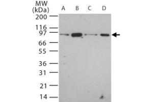 Western blot analysis of Tlr12 in 20 ug/lane of mouse (A) brain, (B) heart, (C) small intestine, (D) kidney tissue lysate. (TLR12 anticorps  (AA 700-800))