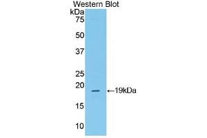 Western blot analysis of the recombinant protein. (CRH anticorps  (AA 40-195))