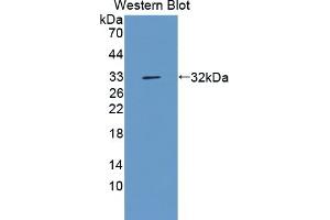 Detection of Recombinant AGC, Cattle using Polyclonal Antibody to Aggrecan (AGC) (Aggrecan anticorps  (AA 2066-2316))