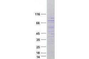 Validation with Western Blot