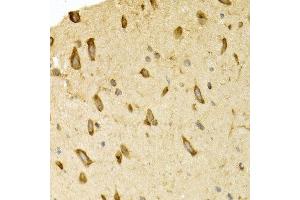 Immunohistochemistry of paraffin-embedded rat brain using APLP1 antibody at dilution of 1:200 (400x lens). (APLP1 anticorps)