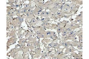 anti-CD14 (CD14) (AA 65-327) antibody