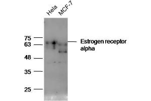 Lane 1: HeLa lysates Lane 2: MCF7 lysates probed with Anti-Estrogen receptor alpha Polyclonal Antibody, Unconjugated  at 1:5000 for 90 min at 37˚C. (Estrogen Receptor alpha anticorps  (AA 241-300))