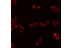 ABIN6273926 staining Hela by IF/ICC. (G Protein-Coupled Receptor 110 anticorps  (C-Term))