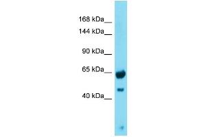 Western Blotting (WB) image for anti-Growth Regulation By Estrogen in Breast Cancer 1 (GREB1) (N-Term) antibody (ABIN2774550) (GREB1 anticorps  (N-Term))