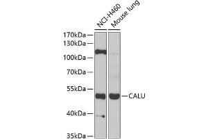 Western blot analysis of extracts of various cell lines, using CALU antibody (ABIN6129533, ABIN6137878, ABIN6137880 and ABIN6222201) at 1:1000 dilution.