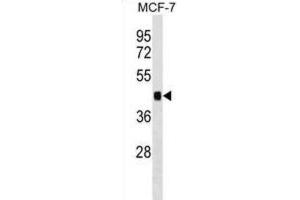 Western Blotting (WB) image for anti-Immediate Early Response 5 (IER5) antibody (ABIN2999398) (IER5 anticorps)