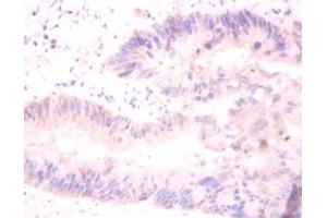 Immunohistochemistry of paraffin-embedded mouse liver using H2AFJ antibody at dilution of 1:100. (H2AFJ anticorps)