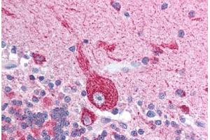 Human Brain, Cerebellum (formalin-fixed, paraffin-embedded) stained with VDAC2 antibody ABIN213732 at 2.