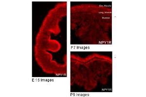 Immunohistochemistry with gut tissue