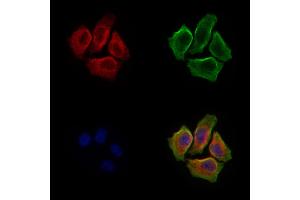 ABIN6260382 and ABIN6279246 staining Hela cells by IF/ICC. (CA7 anticorps  (C-Term))