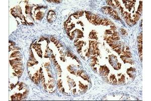 Immunohistochemical staining of paraffin-embedded Human prostate tissue using anti-PANK2 mouse monoclonal antibody. (PANK2 anticorps)