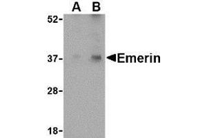 Western blot analysis of Emerin in human skeletal muscle tissue lysate with AP30313PU-N Emerin antibody at (A) 0. (Emerin anticorps  (N-Term))