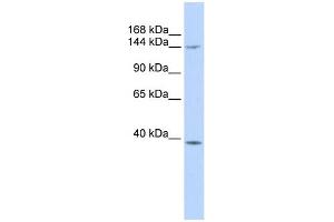 WB Suggested Anti-SMC4 Antibody Titration:  0. (SMC4 anticorps  (Middle Region))