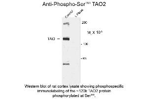 Western blot of Anti-TAO2 pS181 (Rabbit) Antibody - 600-401-E41 Western Blot of Rabbit anti-TAO2 pS181 antibody. (TAO Kinase 2 anticorps  (pSer181))
