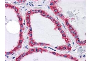 Immunohistochemical analysis of paraffin-embedded human Thyroid tissues using HSPA5 mouse mAb