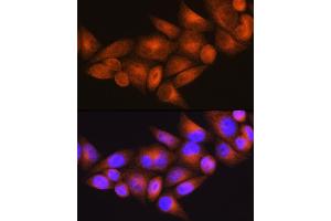 Immunofluorescence analysis of HeLa cells using WFS1 Rabbit pAb (ABIN3022419, ABIN3022420, ABIN1513689, ABIN1514834 and ABIN6218806) at dilution of 1:100 (40x lens). (WFS1 anticorps  (AA 1-285))