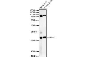 Western blot analysis of extracts of various cell lines, using CEBPD antibody (ABIN7266160) at 1:1340 dilution. (CEBPD anticorps  (AA 1-269))