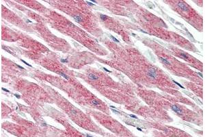 Human Heart (formalin-fixed, paraffin-embedded) stained with MAP3K5 antibody ABIN461897 at 5 ug/ml followed by biotinylated goat anti-rabbit IgG secondary antibody ABIN481713, alkaline phosphatase-streptavidin and chromogen.