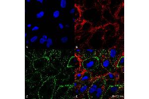 Immunocytochemistry/Immunofluorescence analysis on non-permeabilized HCT116 cells using Mouse Anti-HSP70 Monoclonal Antibody, Clone 1H11: FITC conjugate  showing cell membrane staining. (HSP70 anticorps  (Atto 488))