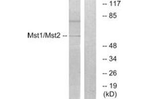 Western blot analysis of extracts from HeLa cells, treated with UV 15', using Mst1/2 (Ab-183) Antibody. (MST1/MST2 (AA 149-198) anticorps)