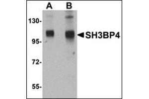 Western blot analysis of SH3BP4 in rat lung tissue lysate with this product at (A) 1 and (B) 2 μg/ml. (SH3BP4 anticorps  (C-Term))