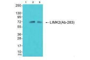 Western blot analysis of extracts from 293 cells (Lane 2) and cos-7 cells (Lane 3), using LIMK2 (Ab-283) antiobdy. (LIMK2 anticorps  (Ser283))