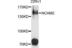 Western blot analysis of extracts of 22Rv1 cells, using NCAM2 antibody (ABIN5972146) at 1/1000 dilution. (NCAM2 anticorps)