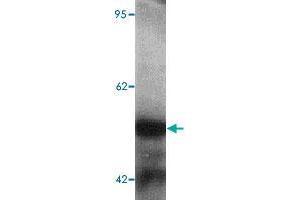 Western blot analysis of human kidney tissue lysate with TTYH2 polyclonal antibody  at 1 ug/mL. (TTYH2 anticorps  (N-Term))