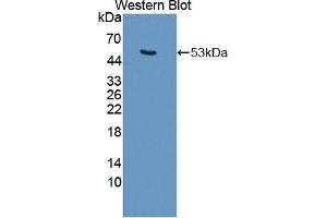 Detection of Recombinant KRT25, Mouse using Polyclonal Antibody to Keratin 25 (KRT25)