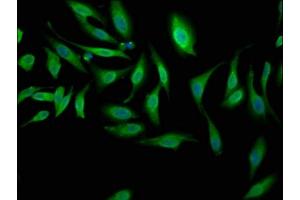 Immunofluorescence staining of Hela cells with ABIN7169088 at 1:100, counter-stained with DAPI. (NEK1 anticorps  (AA 626-809))