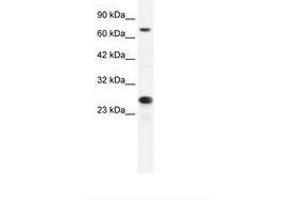 Image no. 2 for anti-Minichromosome Maintenance Complex Component 6 (MCM6) (C-Term) antibody (ABIN202926) (MCM6 anticorps  (C-Term))