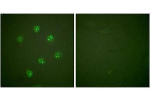 Immunofluorescence analysis of COS7 cells, using Ki67antibody. (Ki-67 anticorps  (C-Term))