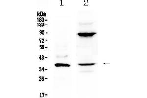 Western blot analysis of IL12B using anti-IL12B antibody .