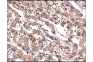 anti-Metastasis Associated in Colon Cancer 1 (MACC1) (Center) antibody