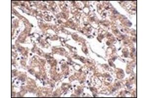 Immunohistochemistry of MACC1 in human liver tissue with this product at 2. (MACC1 anticorps  (Center))