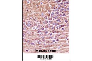 Mouse Prkaca/Prkacb Antibody immunohistochemistry analysis in formalin fixed and paraffin embedded mouse brain tissue followed by peroxidase conjugation of the secondary antibody and DAB staining. (PRKACA/PRKACB anticorps  (C-Term))