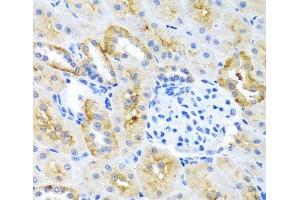 Immunohistochemistry of paraffin-embedded Mouse kidney using MOK Polyclonal Antibody at dilution of 1:100 (40x lens).