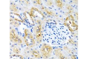 Immunohistochemistry of paraffin-embedded Mouse kidney using MOK Polyclonal Antibody at dilution of 1:100 (40x lens). (MOK anticorps)