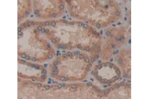 IHC-P analysis of Human Tissue, with DAB staining. (IL21 Receptor anticorps  (AA 23-185))