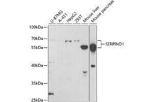 Western blot analysis of extracts of various cell lines, using SERPIND1 antibody (ABIN6131316, ABIN6147598, ABIN6147599 and ABIN6221548) at 1:1000 dilution.