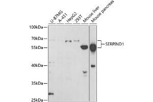 Western blot analysis of extracts of various cell lines, using SERPIND1 antibody (ABIN6131316, ABIN6147598, ABIN6147599 and ABIN6221548) at 1:1000 dilution. (SERPIND1 anticorps  (AA 20-290))