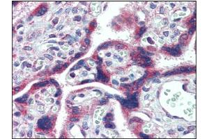 Immunohistochemistry Image: Human Placenta: Formalin-Fixed, Paraffin-Embedded (FFPE) (FMR1 anticorps  (C-Term, Internal Region))