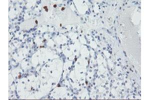 Image no. 2 for anti-Ubiquitin Specific Peptidase 36 (USP36) (AA 589-972) antibody (ABIN1491604)