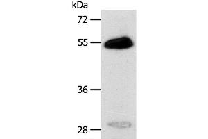Western Blot analysis of Human liver cancer tissue using CA14 Polyclonal Antibody at dilution of 1:400 (CA14 anticorps)