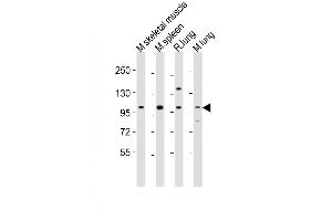 All lanes : Anti-Fgfr4 Antibody (Center) at 1:2000 dilution Lane 1: mouse skeletal muscle lysates Lane 2: mouse spleen lysates Lane 3: rat lung lysates Lane 4: mouse lung lysates Lysates/proteins at 20 μg per lane. (FGFR4 anticorps  (AA 448-482))