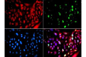 Immunofluorescence analysis of GFP-RNF168 transgenic U2OS cells using UIMC1 antibody (ABIN6128891, ABIN6149915, ABIN6149916 and ABIN6223082).