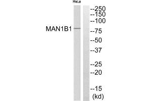 Western Blotting (WB) image for anti-Mannosidase, Alpha, Class 1B, Member 1 (MAN1B1) (Internal Region) antibody (ABIN1851304) (MAN1B1 anticorps  (Internal Region))