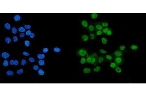 IF analysis of PARP using anti-PARP antibody (ABIN7602276). (PARP1 anticorps  (AA 670-858))