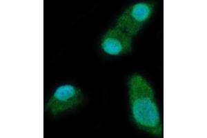 IF analysis of YTHDC2 using anti-YTHDC2 antibody (ABIN7599661). (YTHDC2 anticorps  (AA 105-1231))